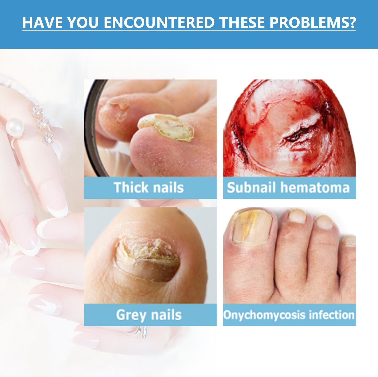 Nighttime Fungal Nail Treatment Patch, Repair Hand And Foot Inlay Rotten Nails Thickening Gray Nail Polish Care Patch