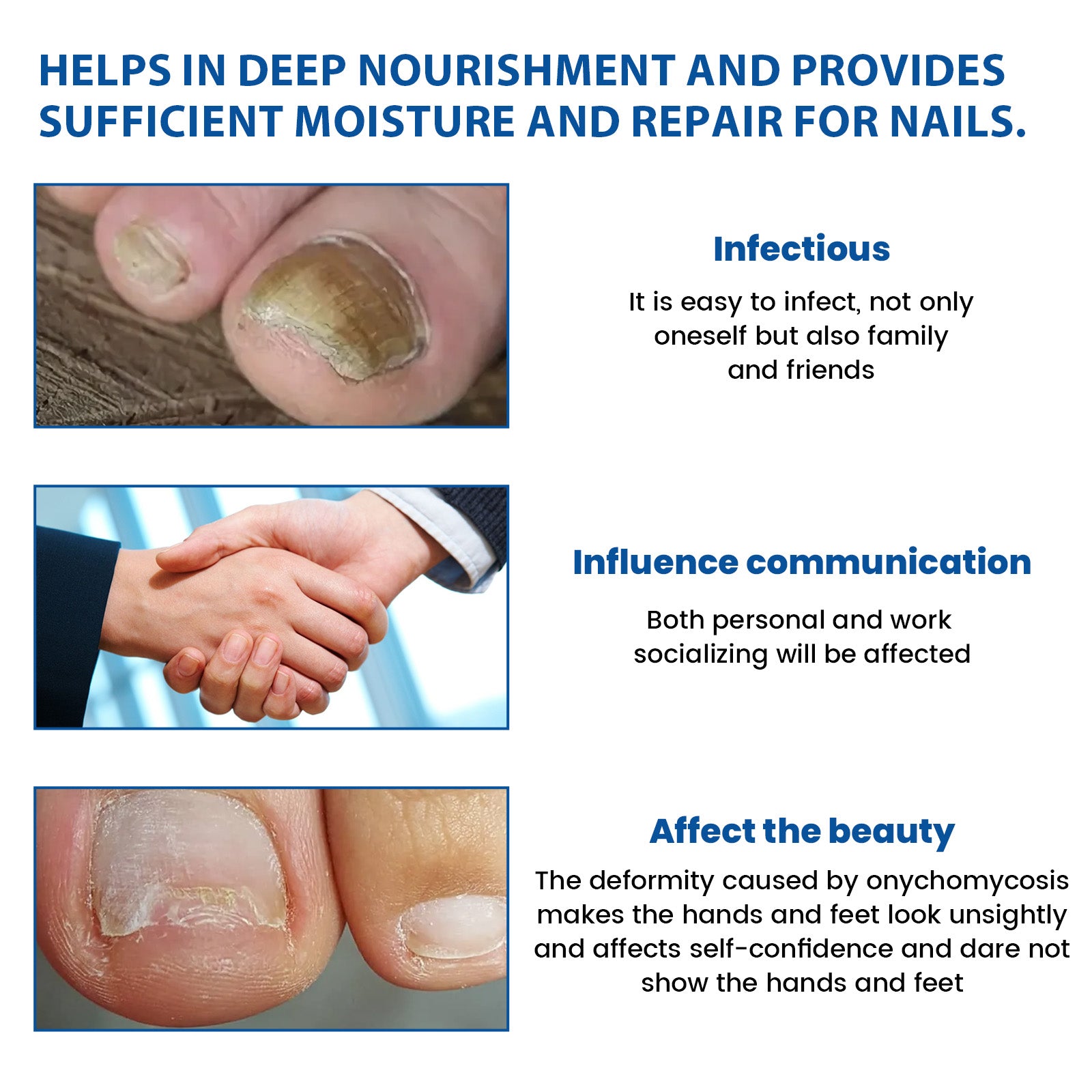 Nighttime Renewal Fungal Nail Patches, Repair And Thickening Gray Nail Insert Soft Nail Care Patch