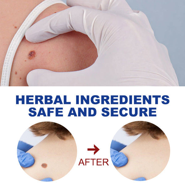 Kayu Liquid Pen Gently Cleanses Skin Care Body Face Label Meat Pellet Kayu Liquid