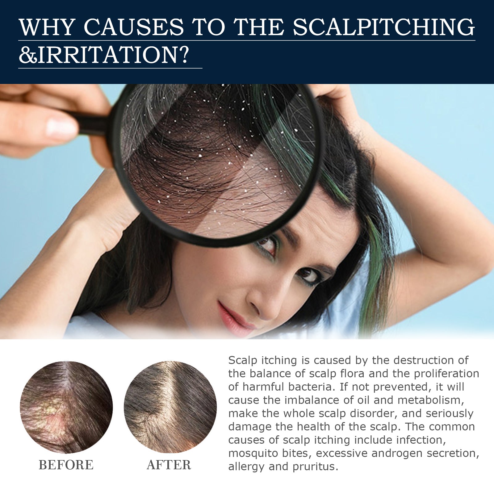 Scalp Treatment Essence Spray, Hair Care And Repair Damaged Hair Follicle Hair Root Treatment Spray