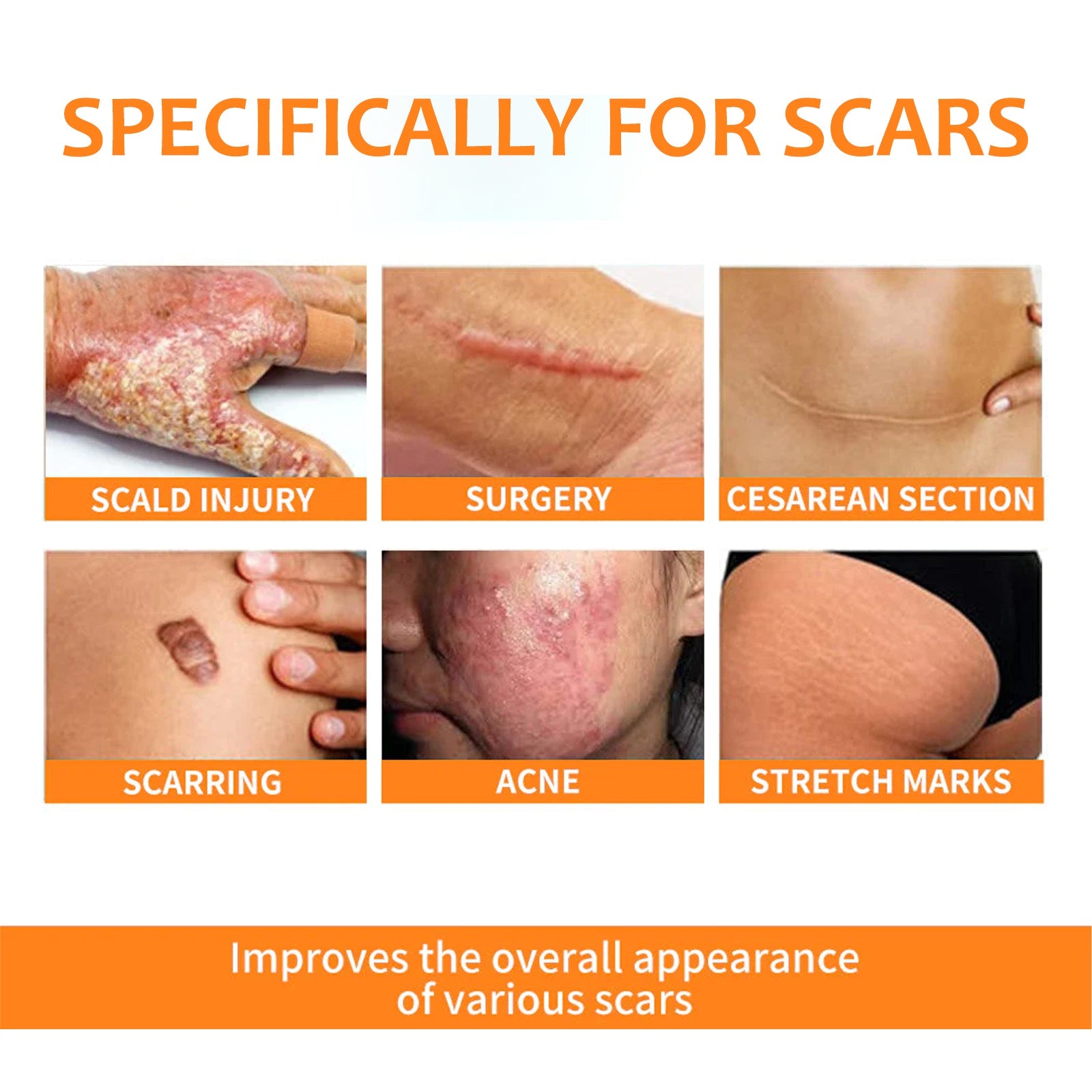 Skin Repair Pen For Reducing Pregnancy Burns Scars And Smoothing The Skin