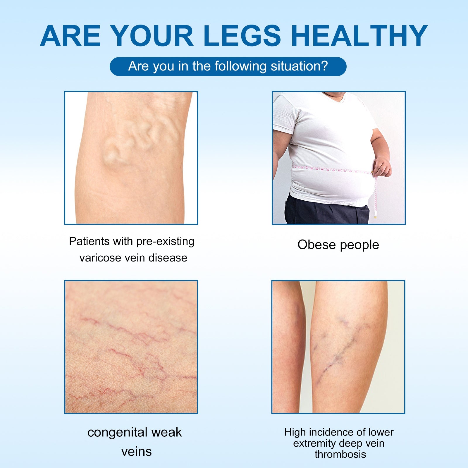 Varicose Vein Slimming Cream, Vein Repair Body Care Reduces Leg Muscle Swelling Earthworm Leg Slimming Cream