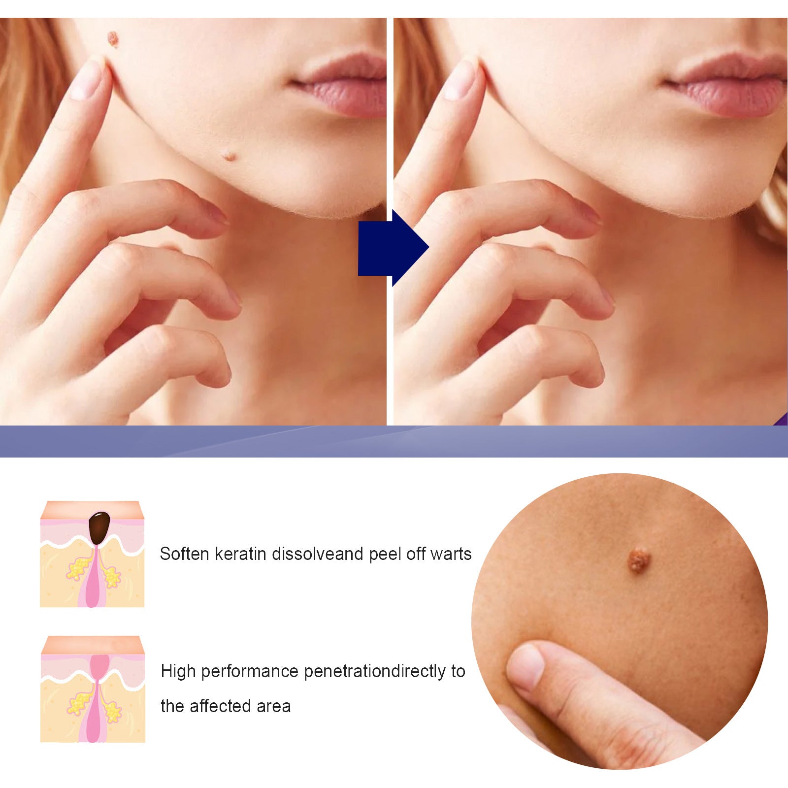 Skin Care Cream Moisturizing Body Skin Label Gentle Moisturizing Clean Smooth Kayo Care Cream