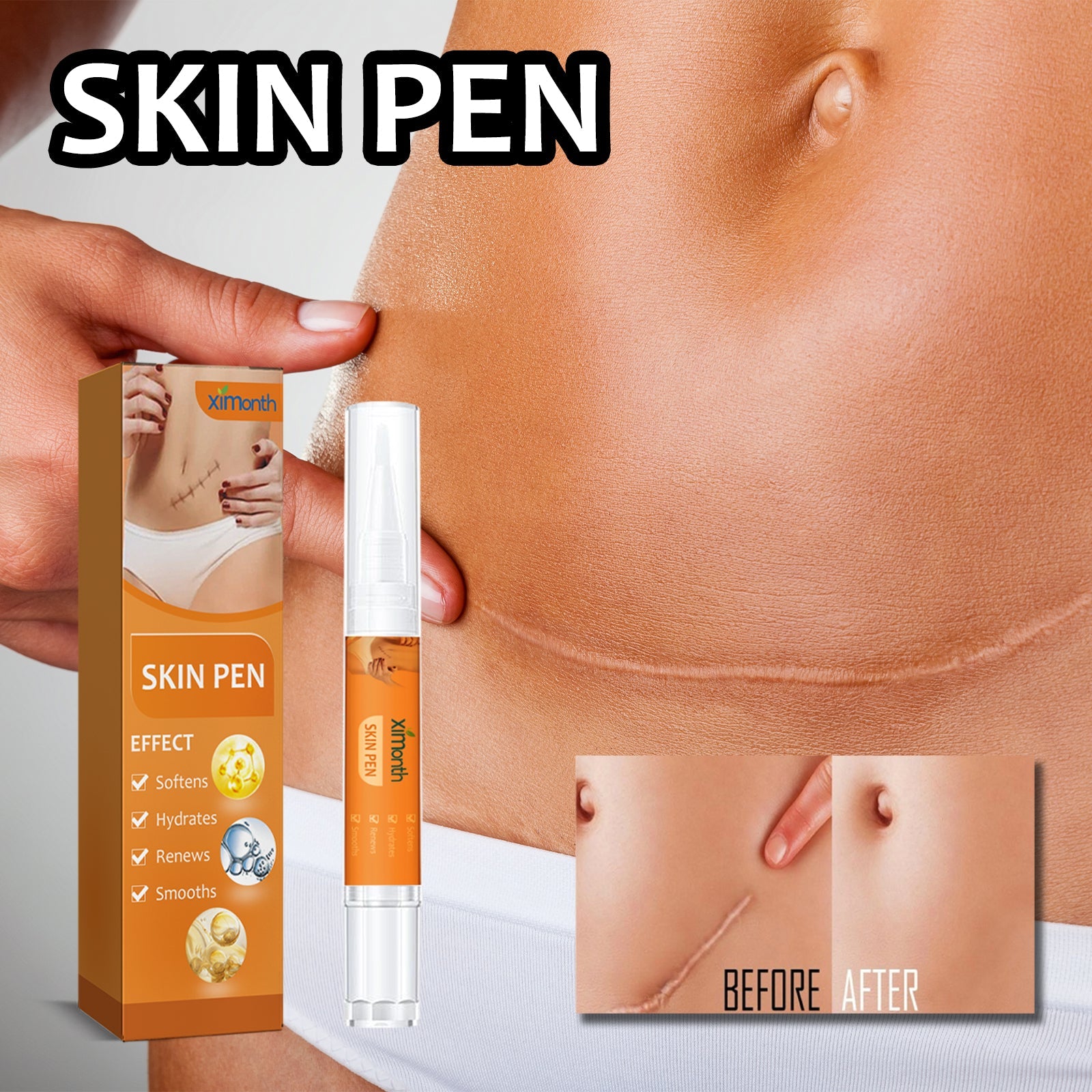 Skin Repair Pen For Reducing Pregnancy Burns Scars And Smoothing The Skin