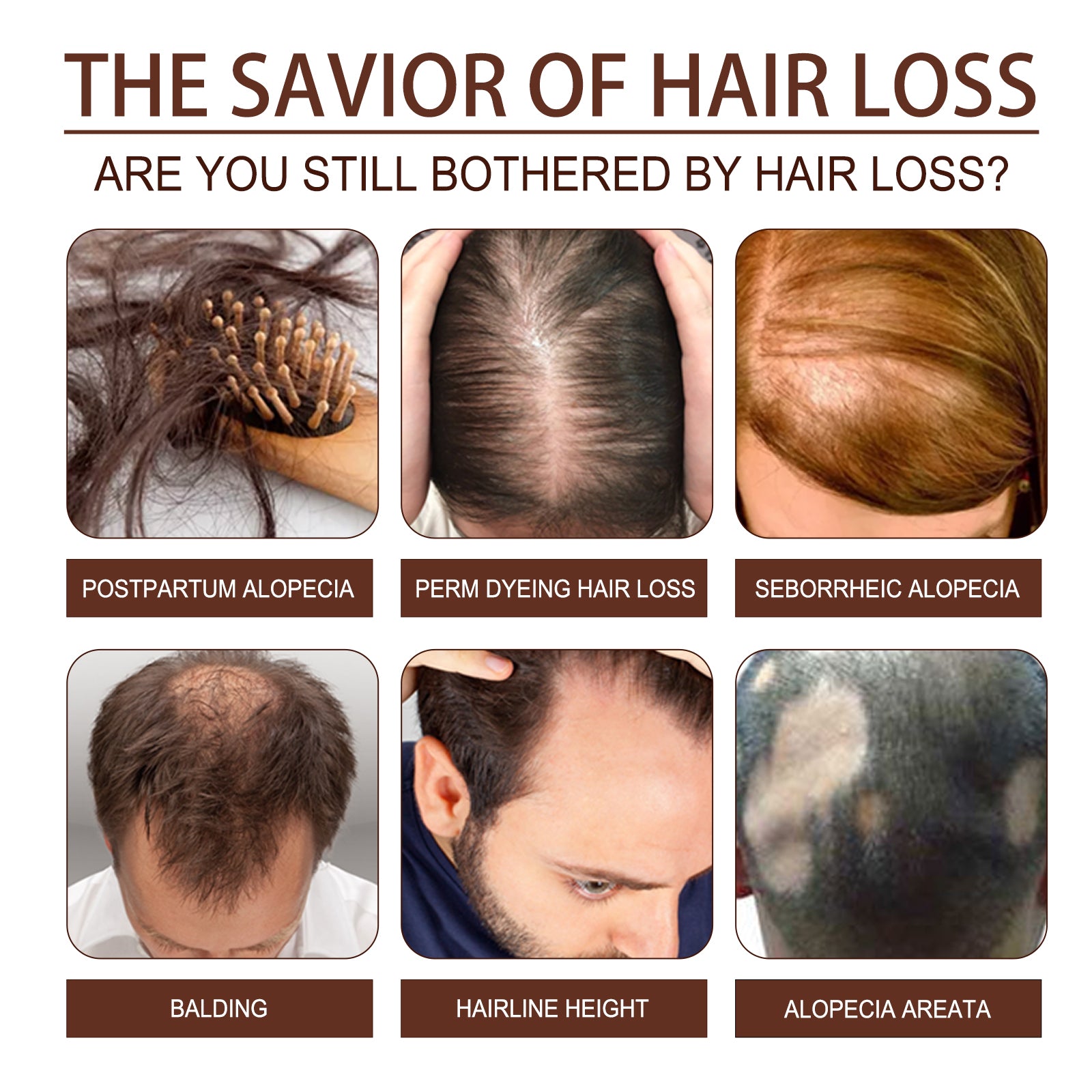 Castor Oil Hair Dense Essential Oil Repair Damaged Hair, Nourish Scalp, Strengthen Hair And Prevent Hair Loss