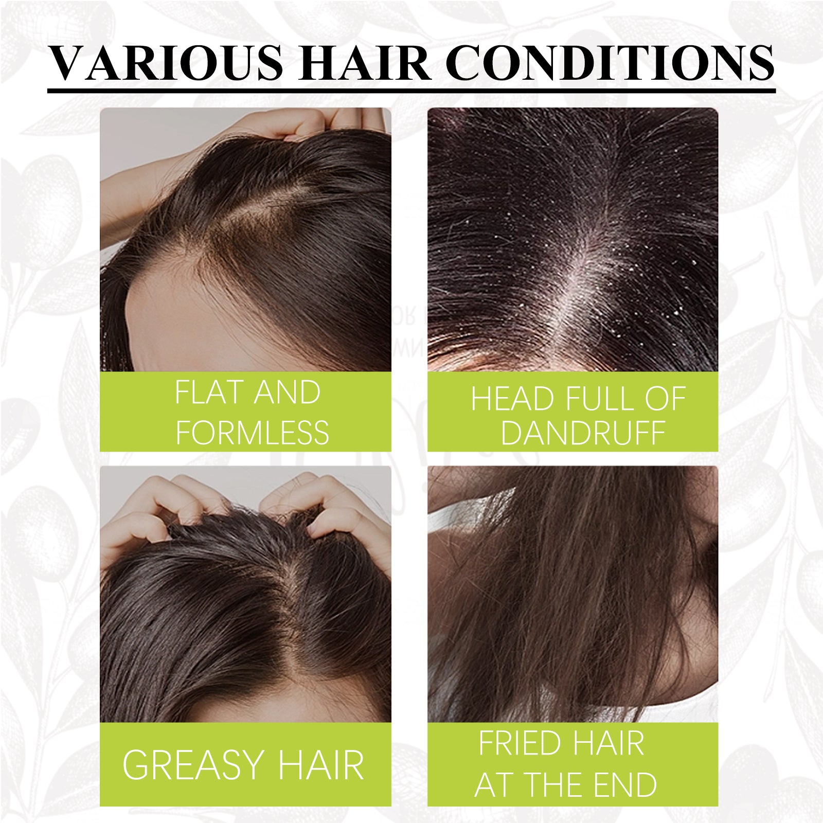 Artemisea Anti-Dandruff Scalp Pigment, Clean Scalp, Relieve Itching And Oil Control, Repair Frizz Damaged Hair Care