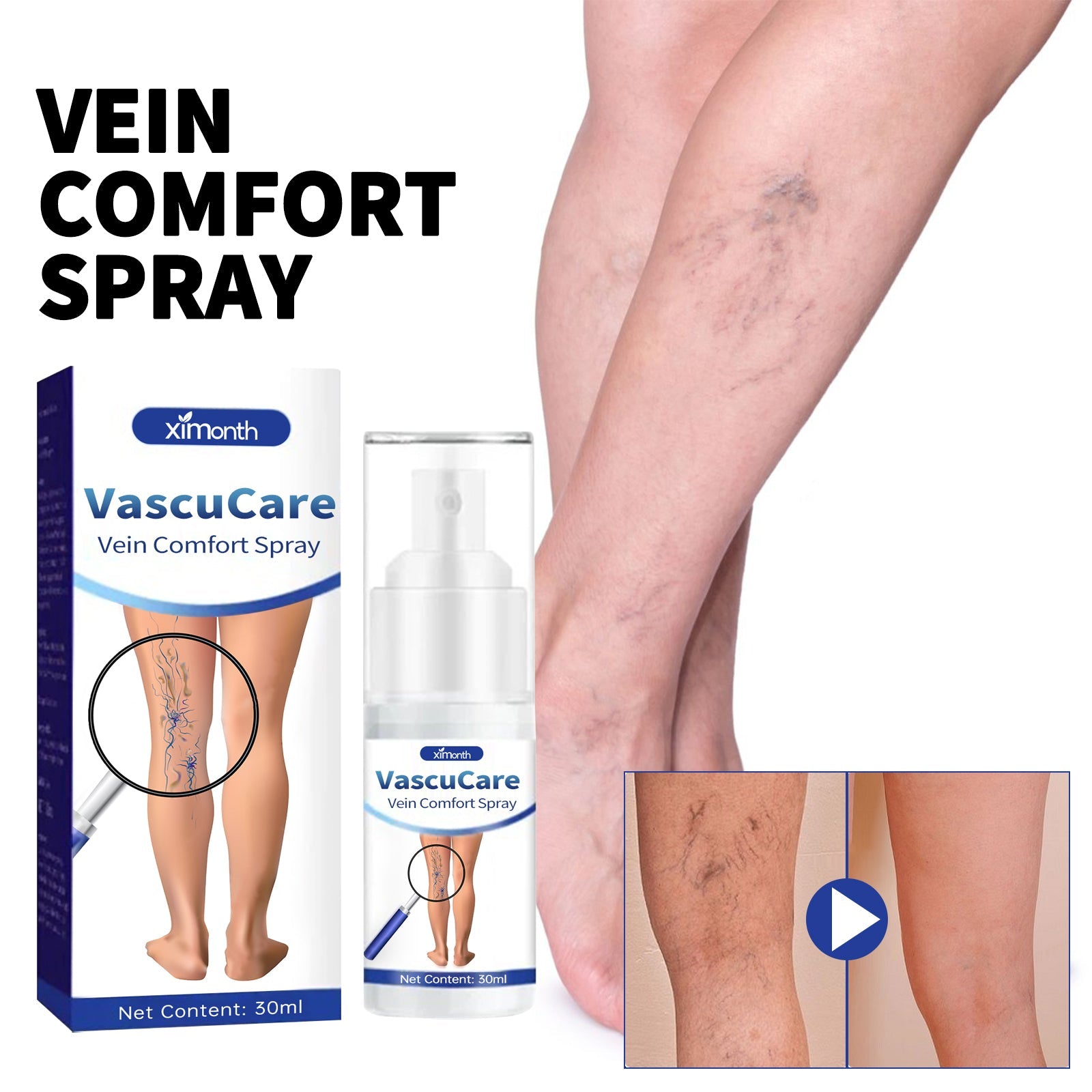 Vein Comfort Spray, Relief Leg Muscle Soreness And Swelling Earthworm Leg Vein Treatment Spray