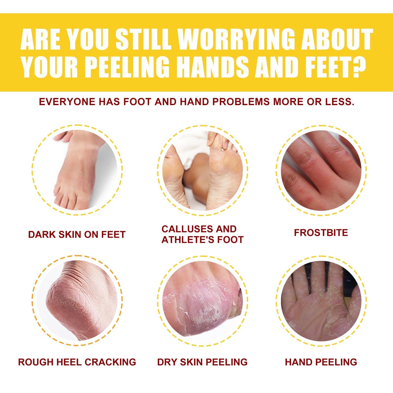 Horse Oil Hand And Foot Repair Cream, Chapped Skin Care Moisturizing And Anti-Peeling Repair Cream