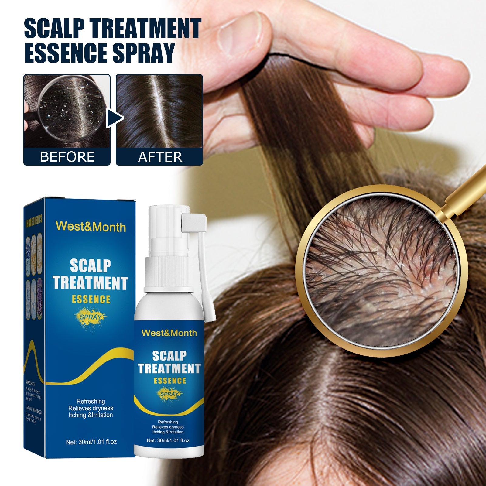 Scalp Treatment Essence Spray, Hair Care And Repair Damaged Hair Follicle Hair Root Treatment Spray