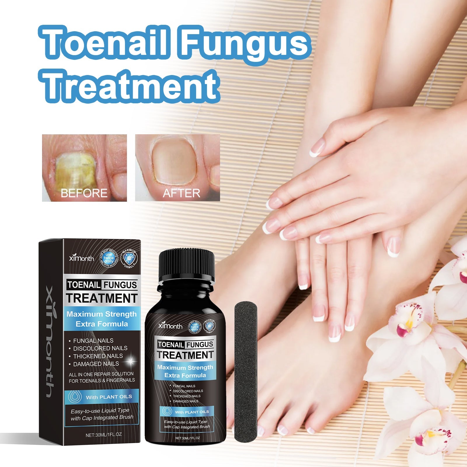 Toenail Fungus Treatment, Repair The Brotherhood Of Nails Rotten Jiasheng Mail This Soft Armour A Detailer
