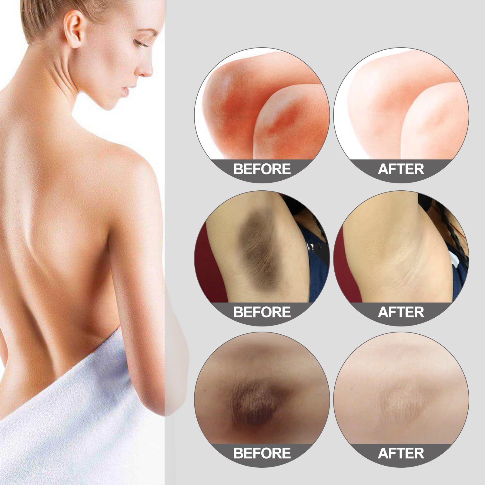 Thigh Radiance Moisturizing And Brightening Cream For Armpit Thighs And Knees