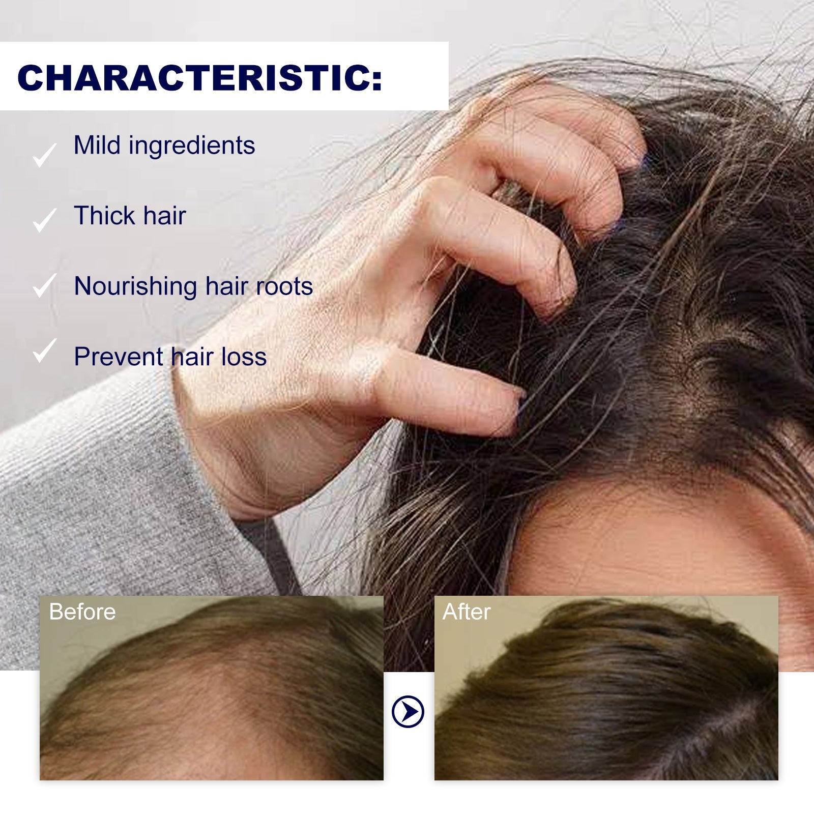 HOEGOA Hair Treatment Roller, Repair Strong And Firm Hair Moistening Hair Roots Thick, Smooth And Dense Hair Care Ball