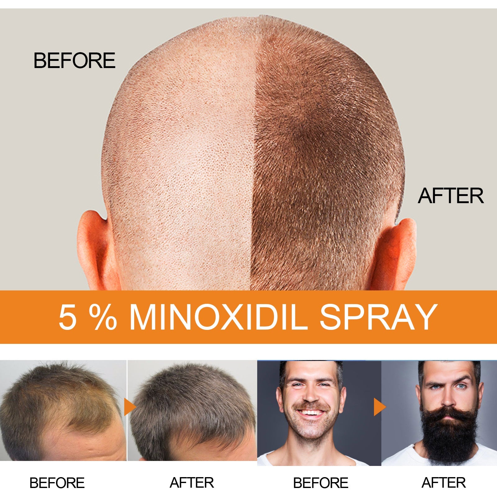 Hair Growth Spray, Men Hair And Beard Thickening Strengthening Anti-loss Care Solution