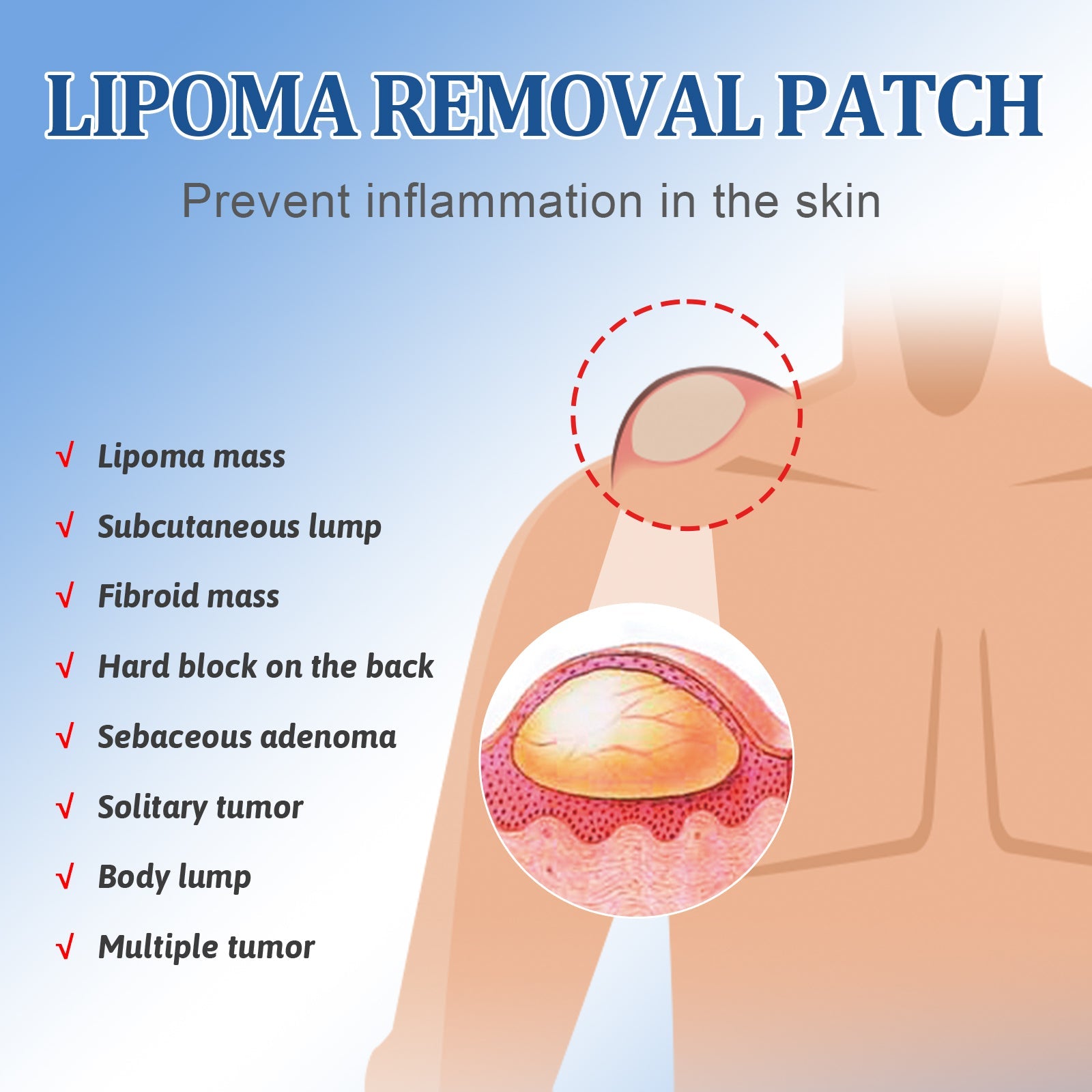 Lipoma Removal Patch, Soothing Various Body Fat Knots To Remove Subcutaneous Lumps Care Patch