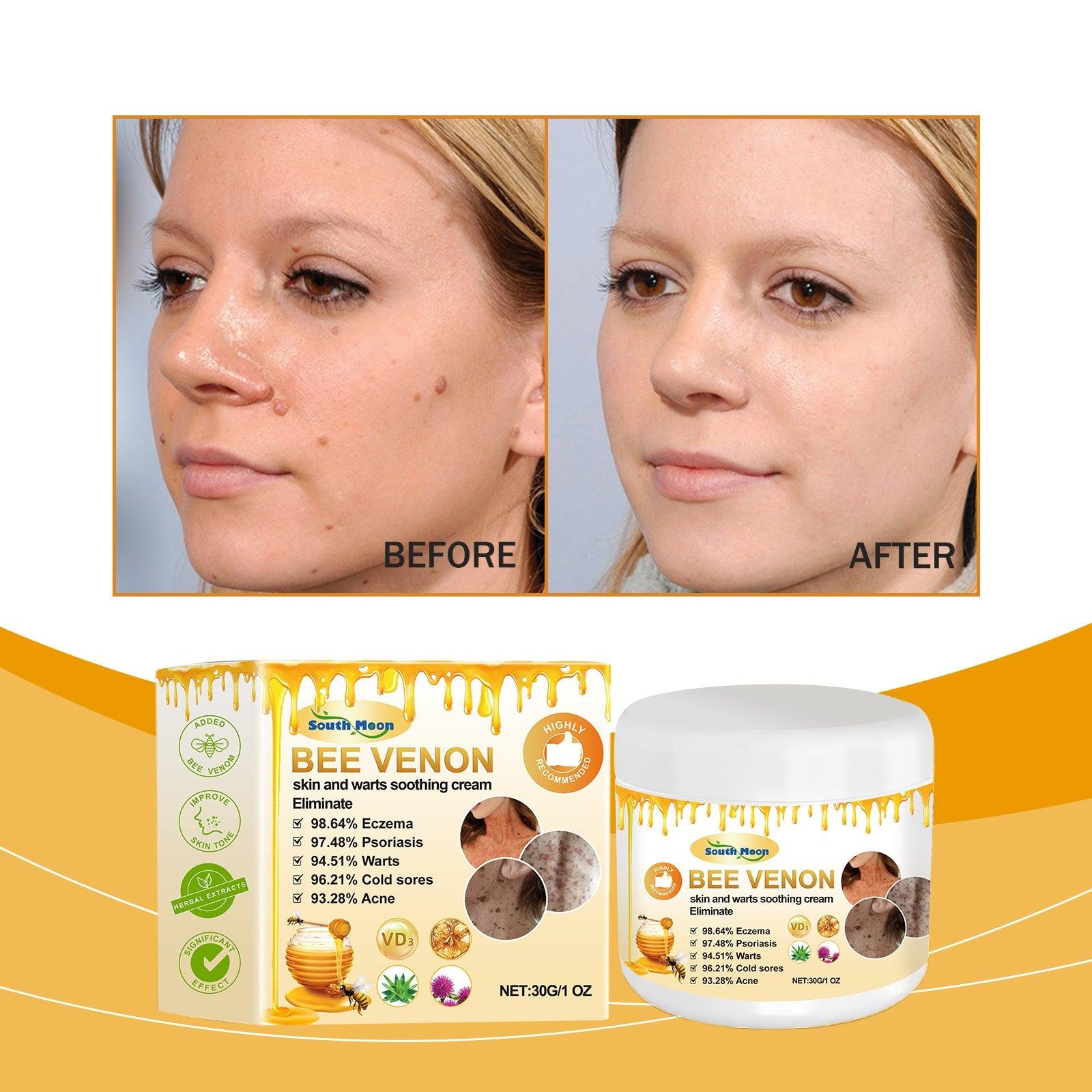 Bee Venom Keyo Cream, Gentle Clean Smooth Skin Moisturizing Moisturizing Daily Massage Keyo Cream