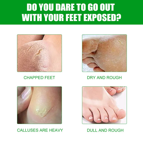 Aloe Vera Foot Mask, Moisturizing Anti-Cracking, Dead Skin Removal, Tender Skin Care Foot Mask