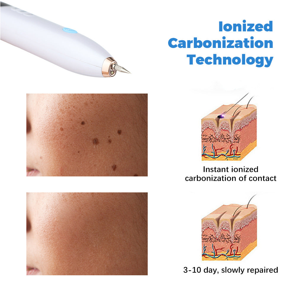 Removal Of Granulation Wart Tattoo Wart Spot Plug-In 9-Speed Laser Sweep Spot Mole Pen With Point Mole Pen Needle