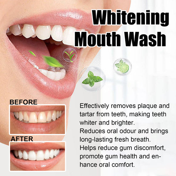 Whitening Mouth Wash, Beauty Shine White Teeth And Fresh Breath Odor Clean Mouth Care Gums