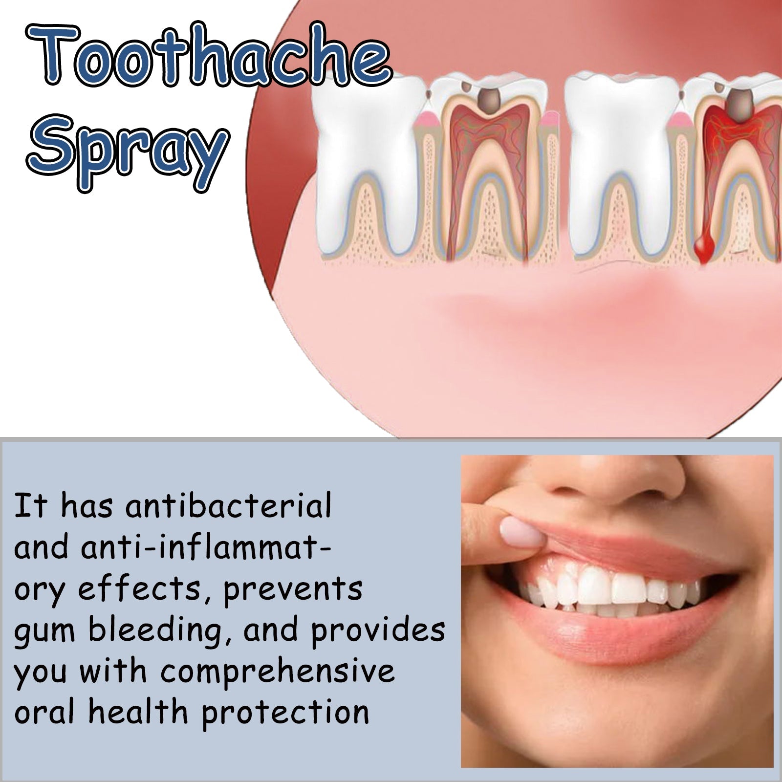 Toothache Treatment Spray. Relieve Gum Swelling And Pain On Fire Care For Teeth Toothache Oral Discomfort Care