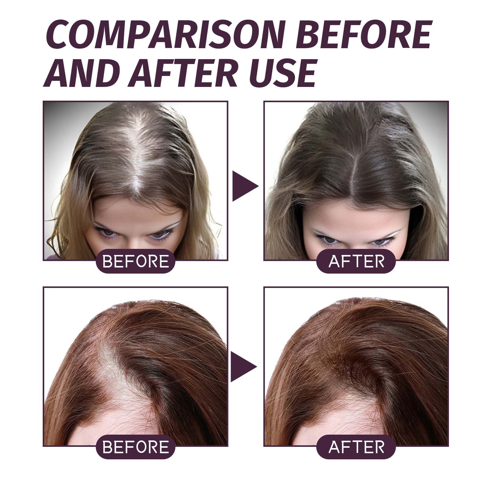 Volumizing And Dense Hair Spray, Repair Dry Hair, Strengthen Hair Nourishing And Volumizing Hair Treatment Spray