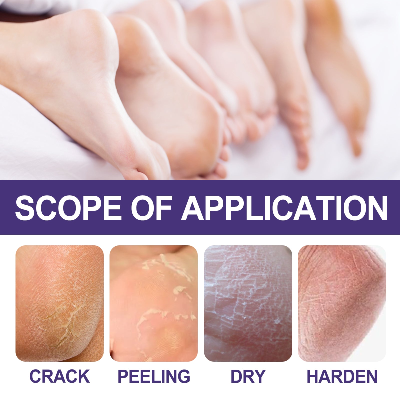 Skin Care Cream, Autumn And Winter Skin Anti-Crack Peeling Exfoliating Moisturizing Soft Moisturizing Body Cream