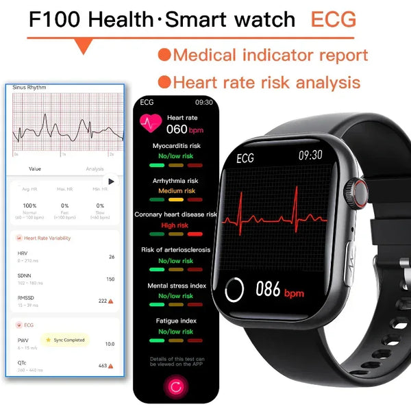 Best ECG Smart Watch of 2024 With Blood Pressure Monitor+Blood Glucose Monitoring - Gifts for You 'n Me