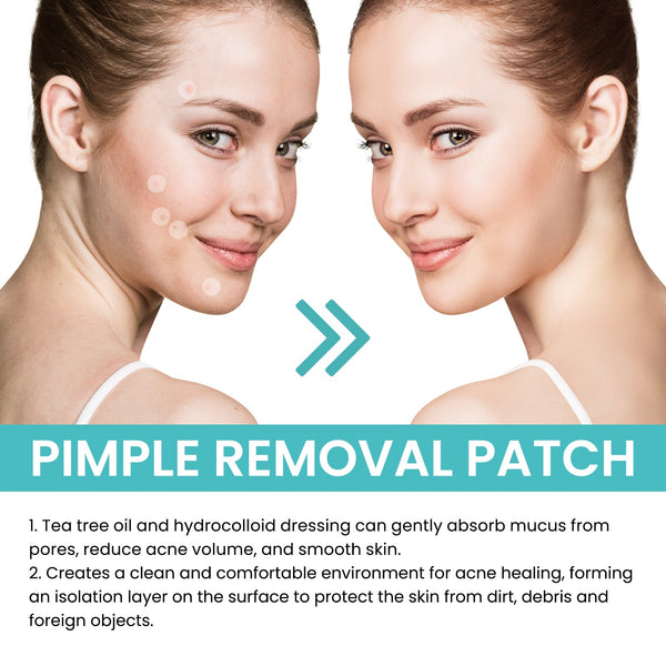 Acne Patch Repair Acne Patch Pore-Cleansing Invisible Breathable Concealer Waterproof Acne Patch