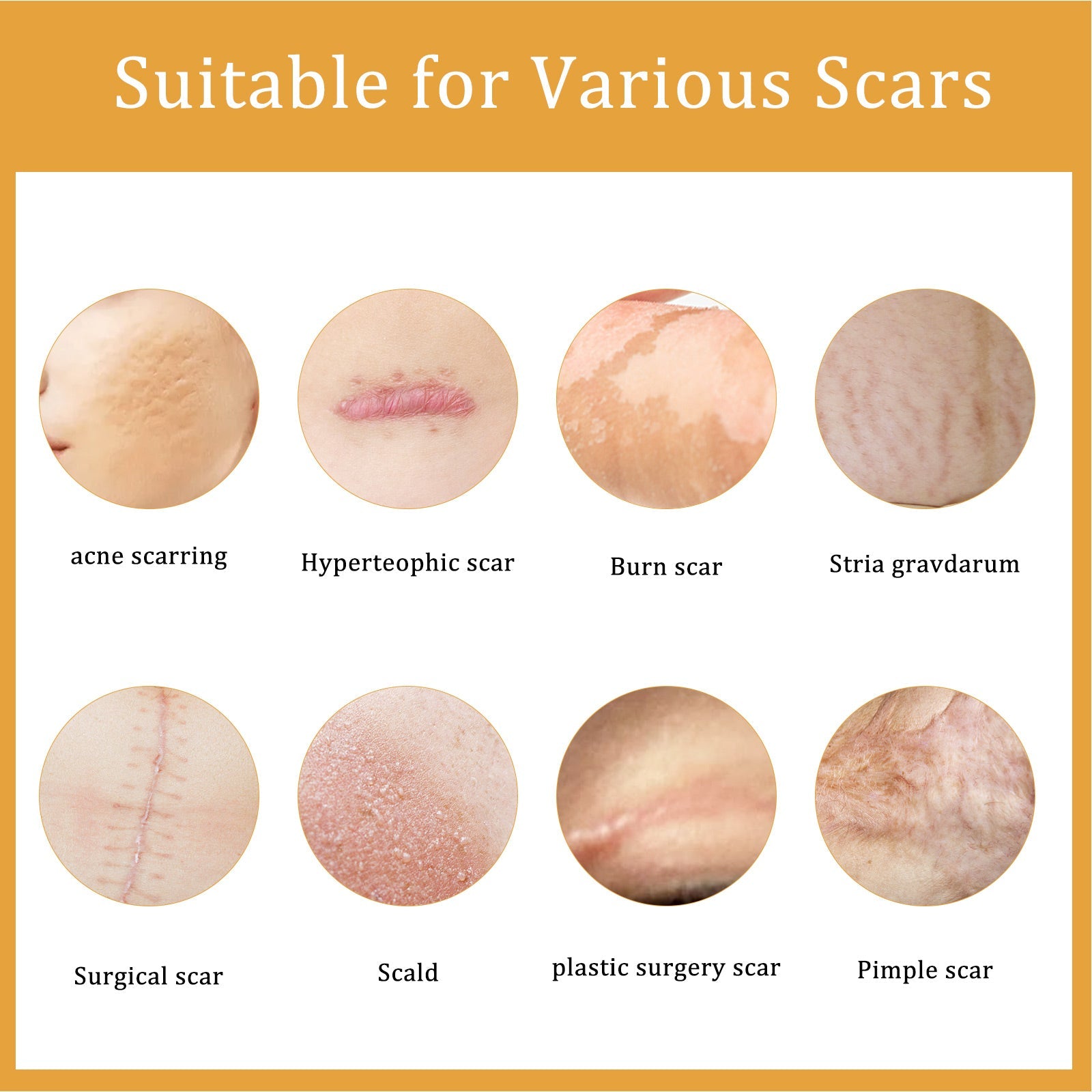 Desalting Skin Scar Cream, Skin Burn Scalding Surgical Scar Wound Repair Cream