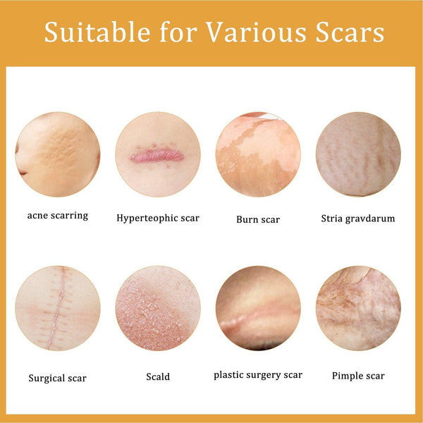 Desalting Skin Scar Cream, Skin Burn Scalding Surgical Scar Wound Repair Cream