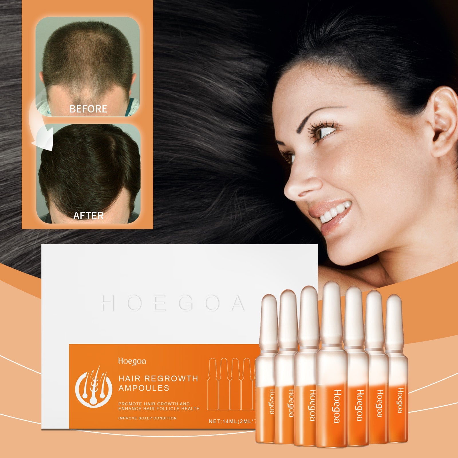 Hair Regrowth Ampoules, Nourish The Scalp To Promote Germinal Nourish Hair Follicle Health Care Essence