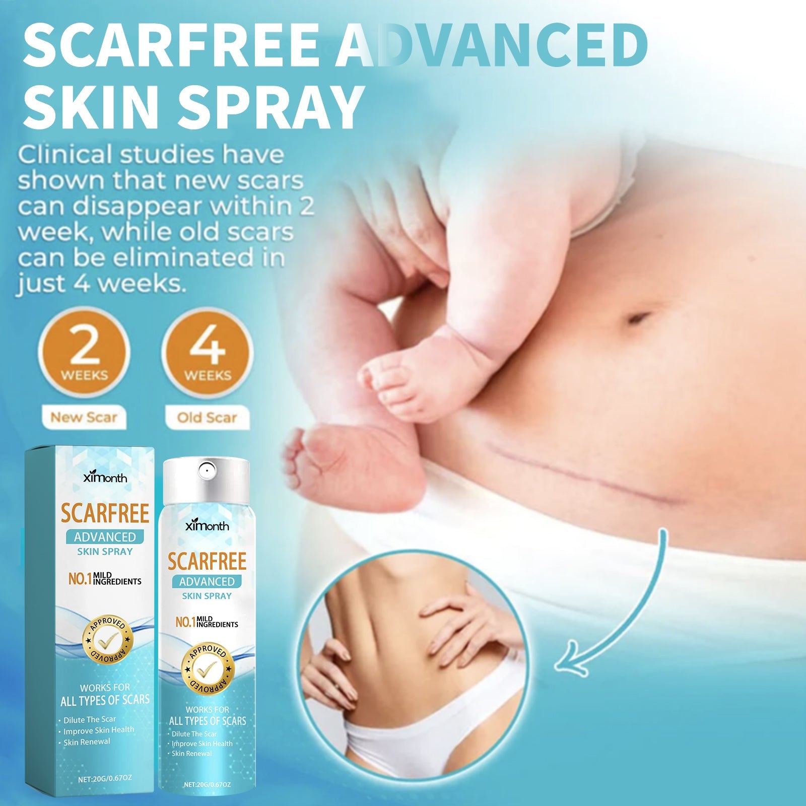Scarfree Advanced Skin Spray, Body Skin Care Reduces Post-Natal Scars And Smooths Skin