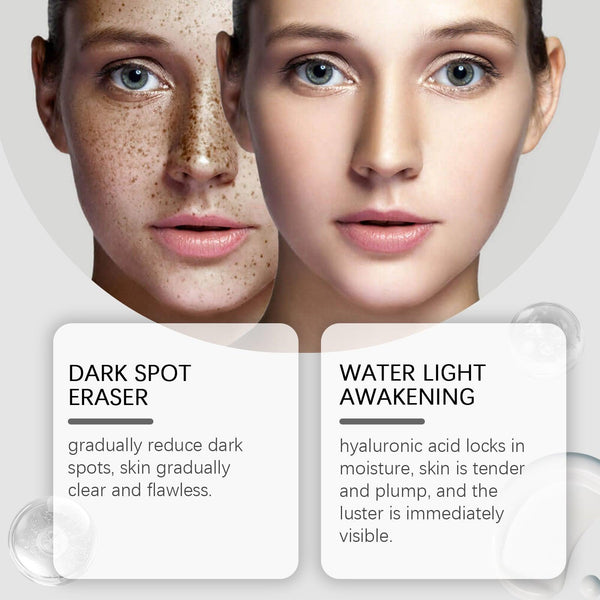 Dark Spot Repair Lotion Moisturizes And Hydrates Facial Skin With Skin Care Spot Repair Lotion