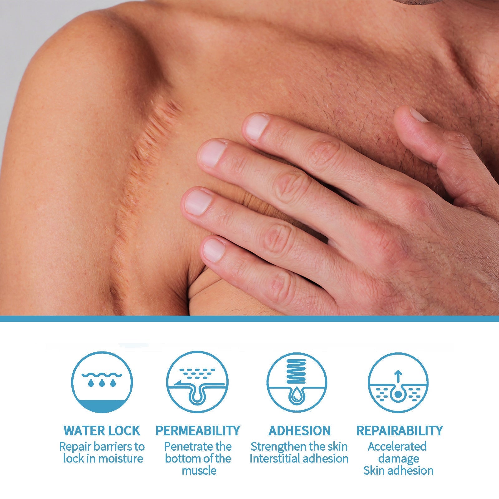 Scar Repair Serum Lightens Post-Pregnancy Scar Repair And Smoothes Body Skin