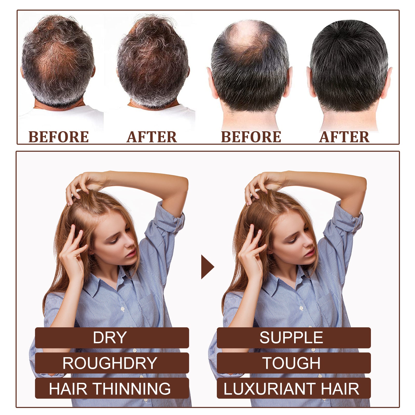 Castor Oil Hair Dense Essential Oil Repair Damaged Hair, Nourish Scalp, Strengthen Hair And Prevent Hair Loss