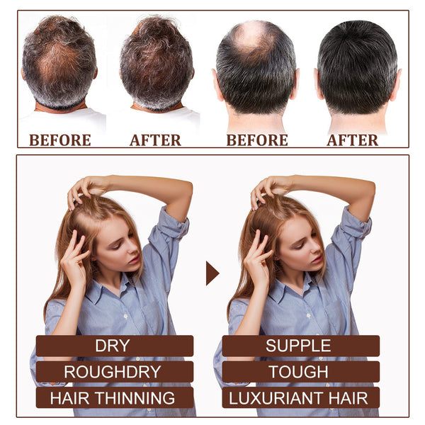 Castor Oil Hair Dense Essential Oil Repair Damaged Hair, Nourish Scalp, Strengthen Hair And Prevent Hair Loss