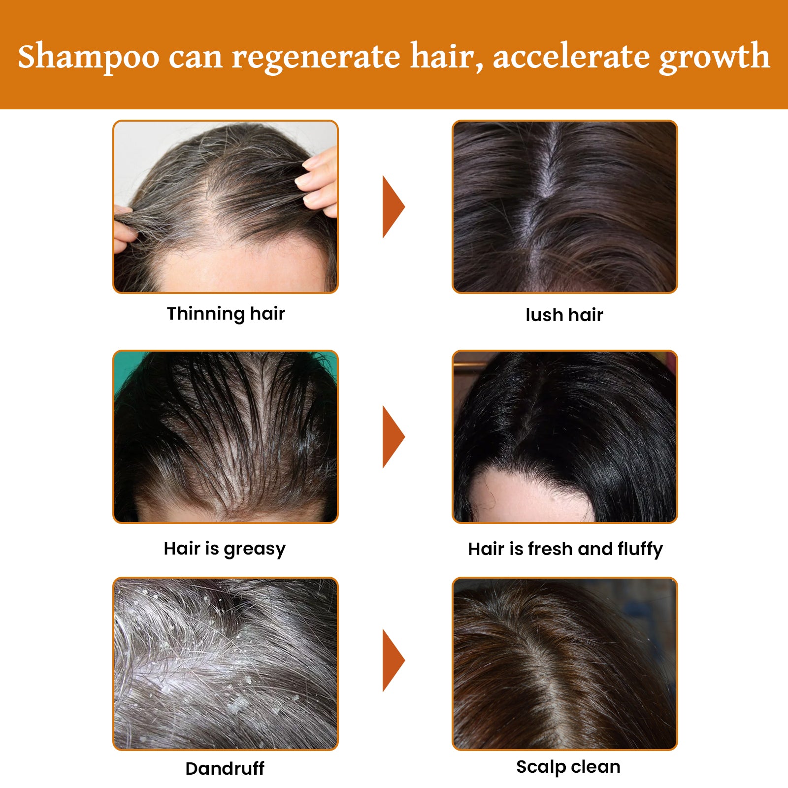 Rice Dense Hair Shampoo Deep Clean Thick Hair Moisturizing Hair Root Solid Hair Care Shampoo