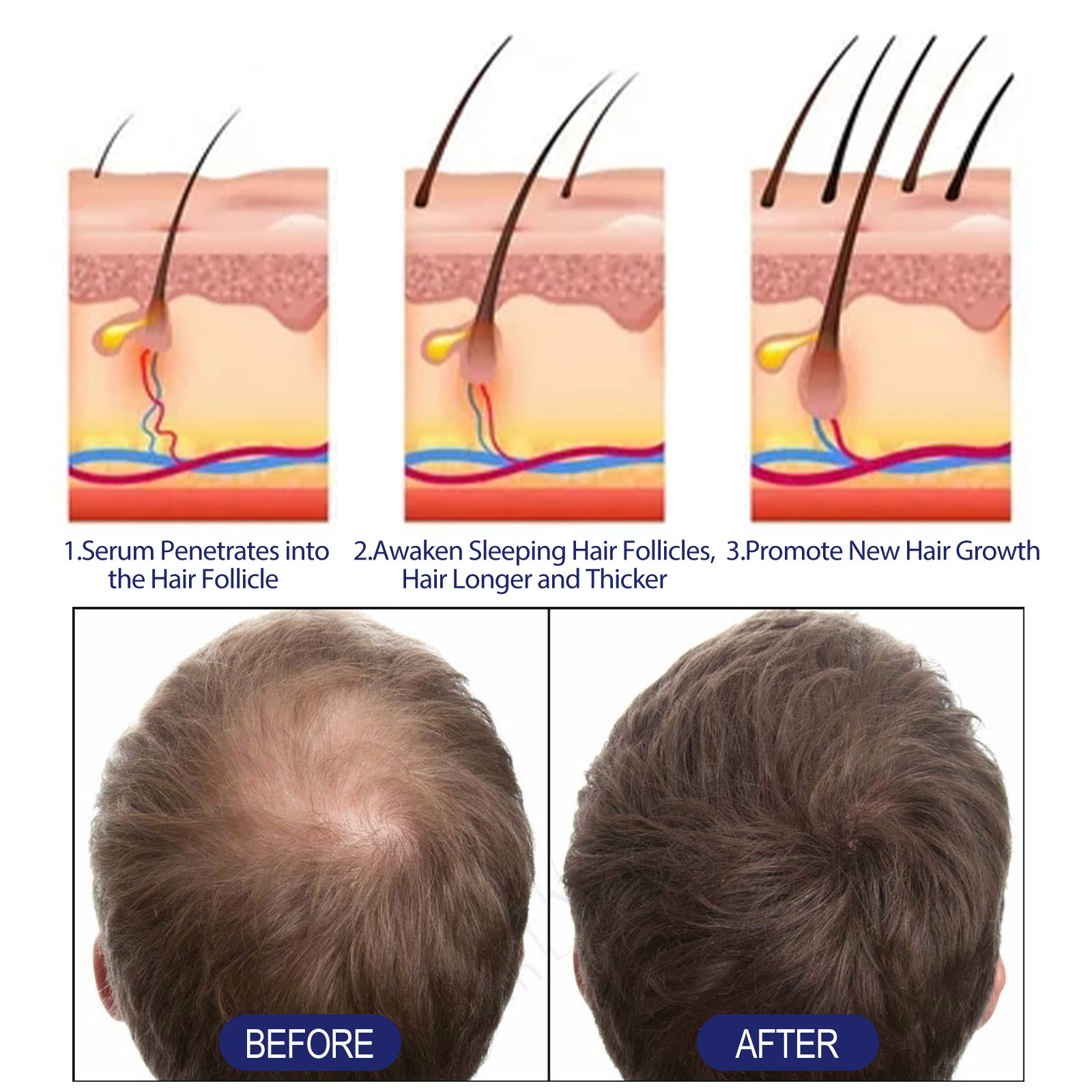 Men's Dense Hair Foam Machine, Repair Hair Root Follicle Men's Hair Thick Moisturizing Foam