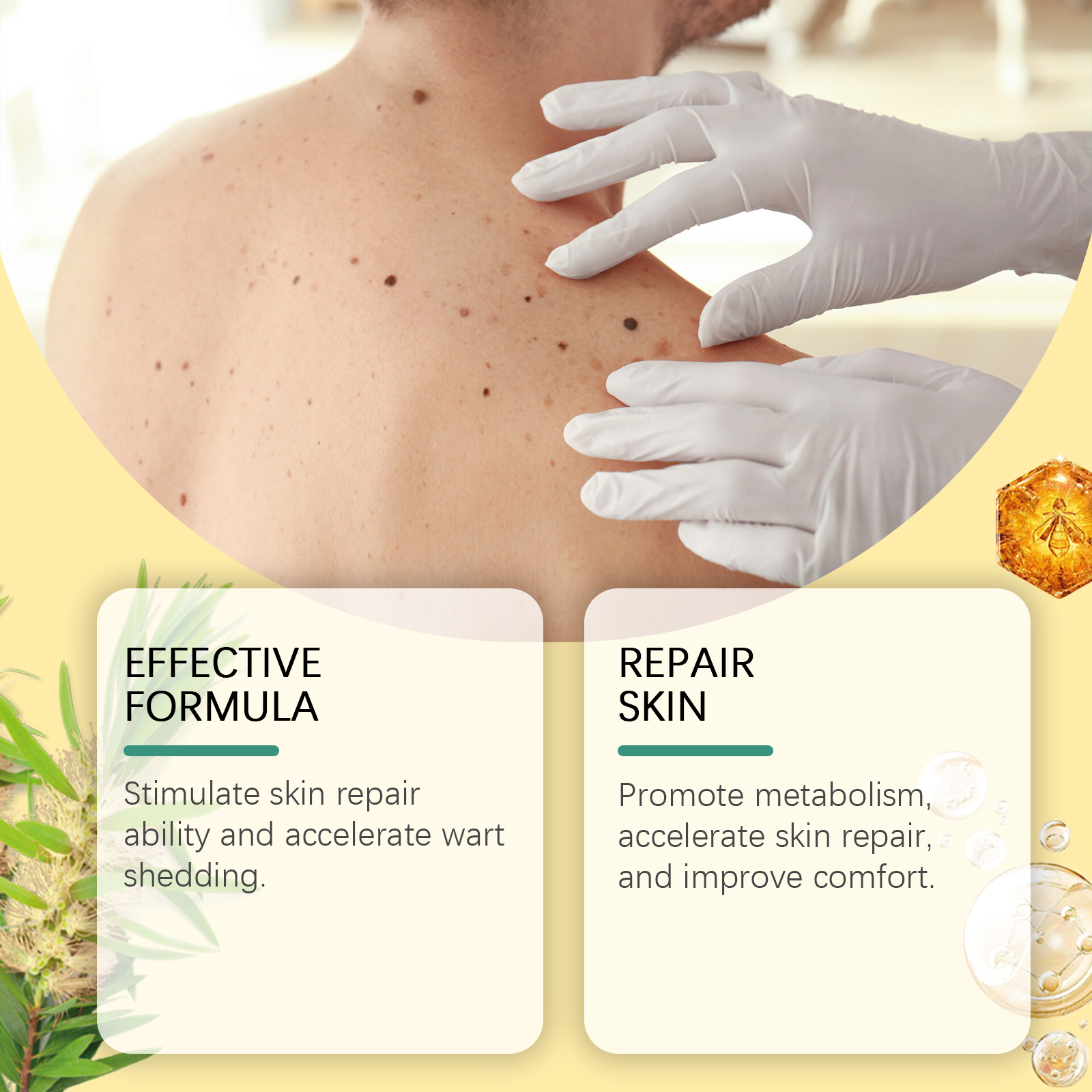 Bee Venom Wart & Mole Removal Spray, Gentle Cleansing Skin Moisturizing Moisturizing Smooth Skin Care