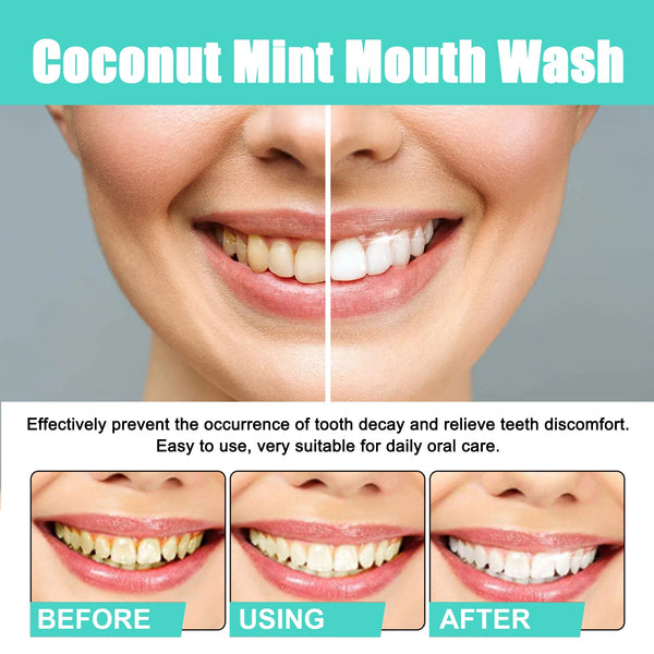 Coconut Mint Mouth Wash, Whitening Teeth Yellow Teeth Stains Tongue Coating Clean Fresh Breath Oral Care