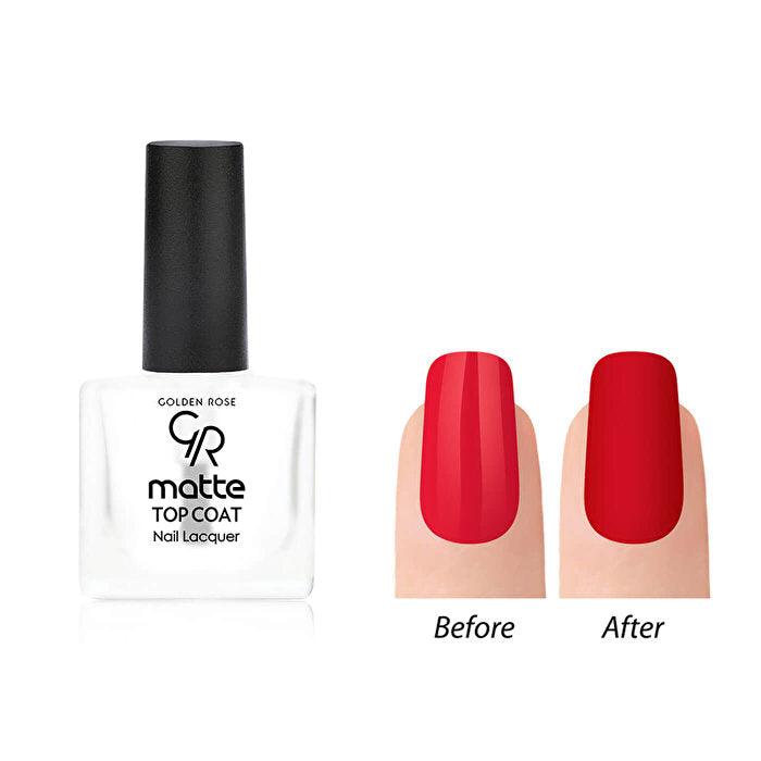 Golden Rose Matte Top Coat - 1 Piece | Nail Polish Finish