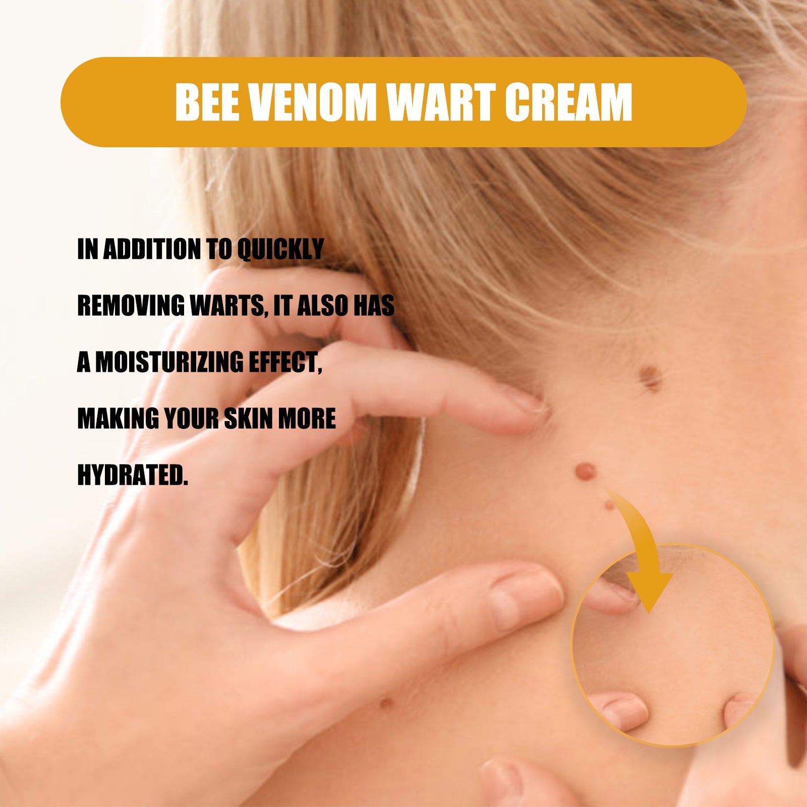 Bee Venom Wart Cream, Repair Smooth Skin Lightening Nevus Spot Nevus Cure Wart Care Cream