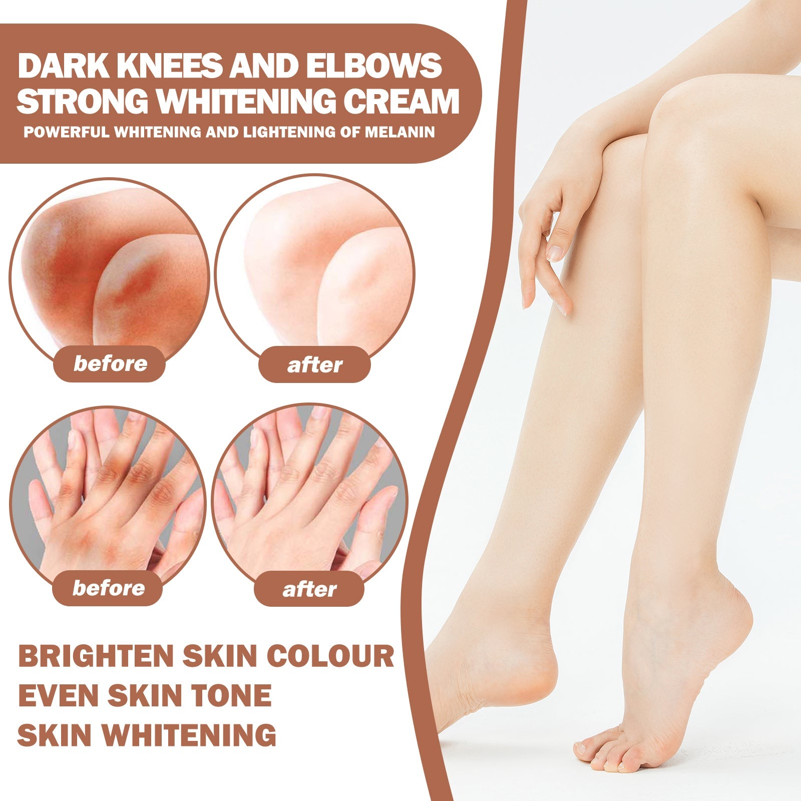 Joint Whitening Cream, Moisturizes Dull Skin Whitening Repair Cream For Joints And Elbows