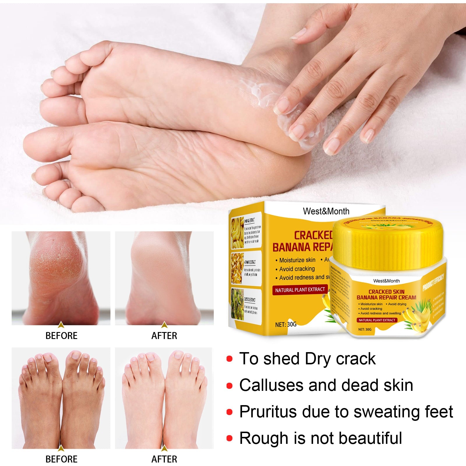 Cracked Skin Banana Repair Cream, Nourishing And Moisturizing Foot Repair Cream To Soften Exfoliation And Remove Dead Skin Calluses