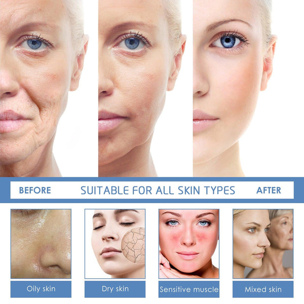 Botox Stock Solution Facial Serum, Firming Light Lines Moisturizing Anti-aging Essence