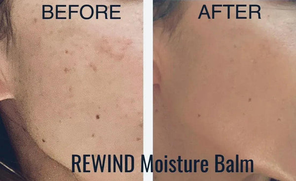 REWIND Stick Hydrating Face Balm with Vitamin C - Gifts for You 'n Me