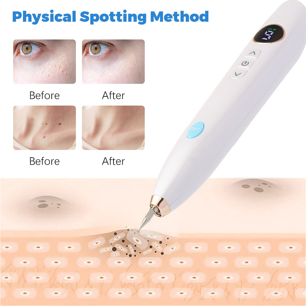 Removal Of Granulation Wart Tattoo Wart Spot Plug-In 9-Speed Laser Sweep Spot Mole Pen With Point Mole Pen Needle