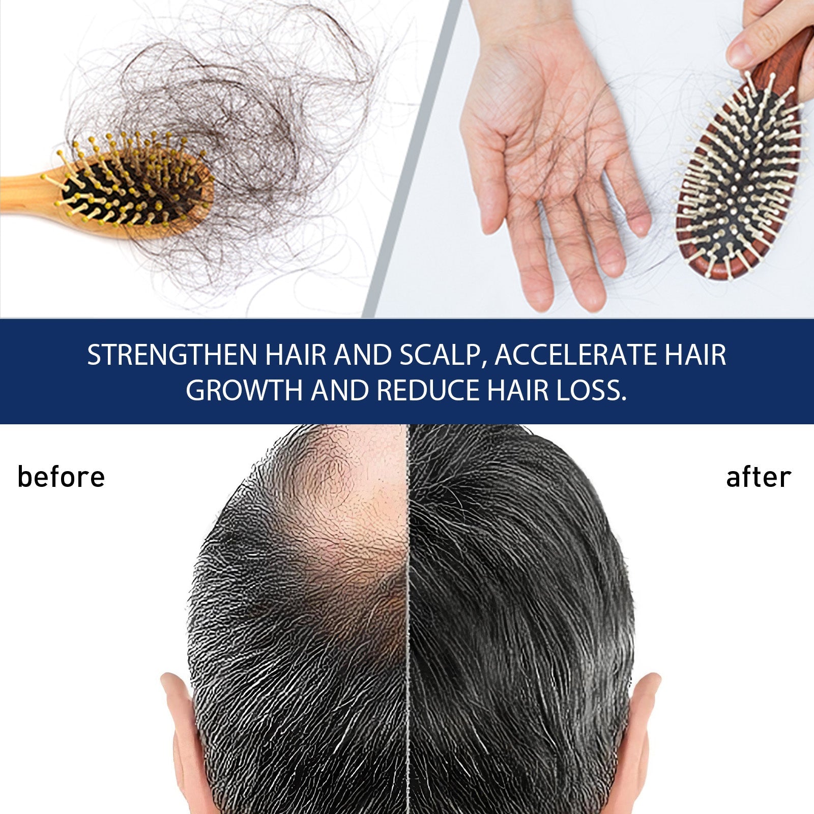 Alopecias Hair Growth Cream, Protect Hair Follicles Strong Moisturizing Thick Hairline Hair