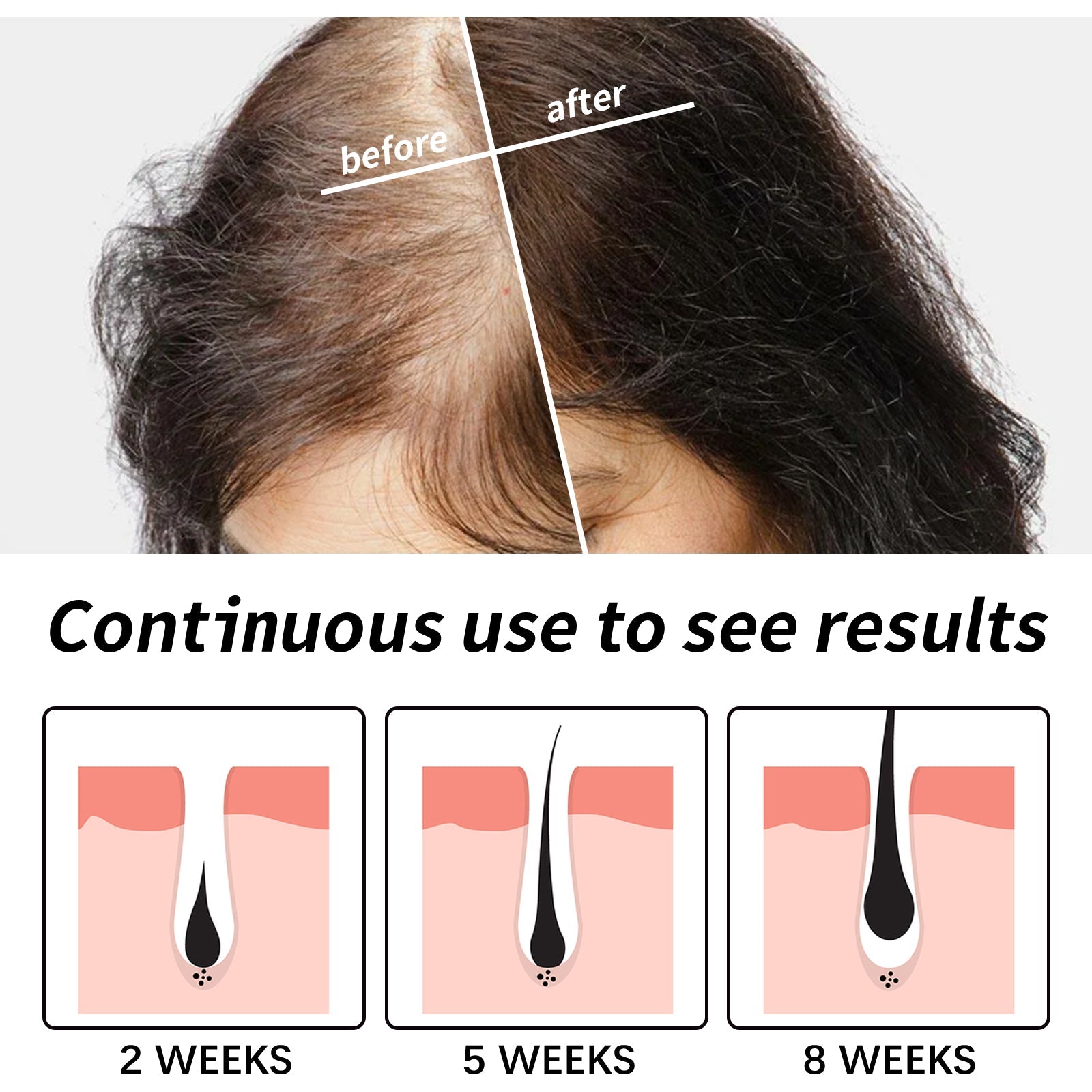 Hair Essence, Repair Dry Hair, Moisturize Hair Roots And Scalp Hair Essence