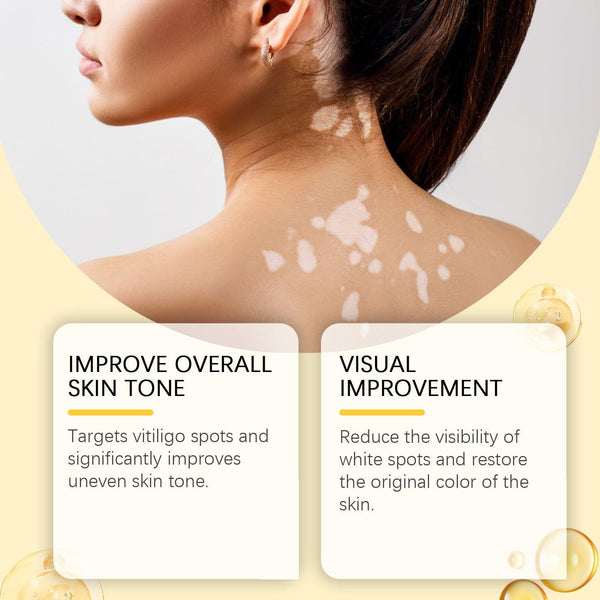 Bee Venom White Spot Care Cream Bee Venom Repair Skin Moisturizing Skin Care Topical Cream