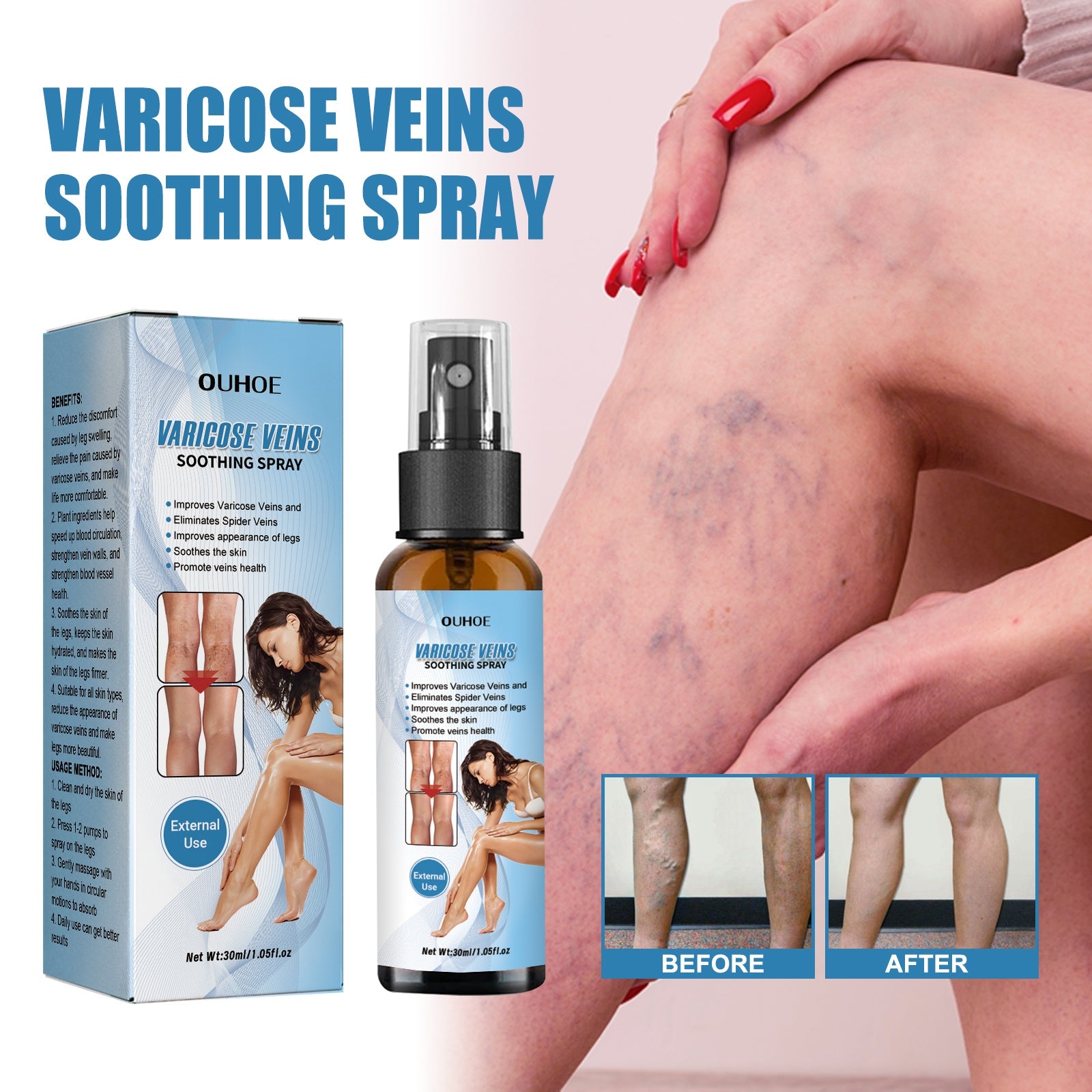 Vein Treatment Spray, Relieve Leg Soreness And Swelling Repair Earthworm Leg Vein Treatment Spray